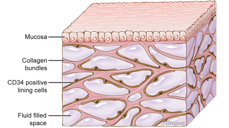 The interstitium, a newly discovered organ that lines nearly the entire body, is an interconnected web of thick connective tissue filled with fluid filled sacs. The organ could help doctors and researchers determine a persons health through examining the interstitial fluid (the liquid found within the sacs). (Illustration by Jill Gregory/Mount Sinai Health System/CC-BY-ND)