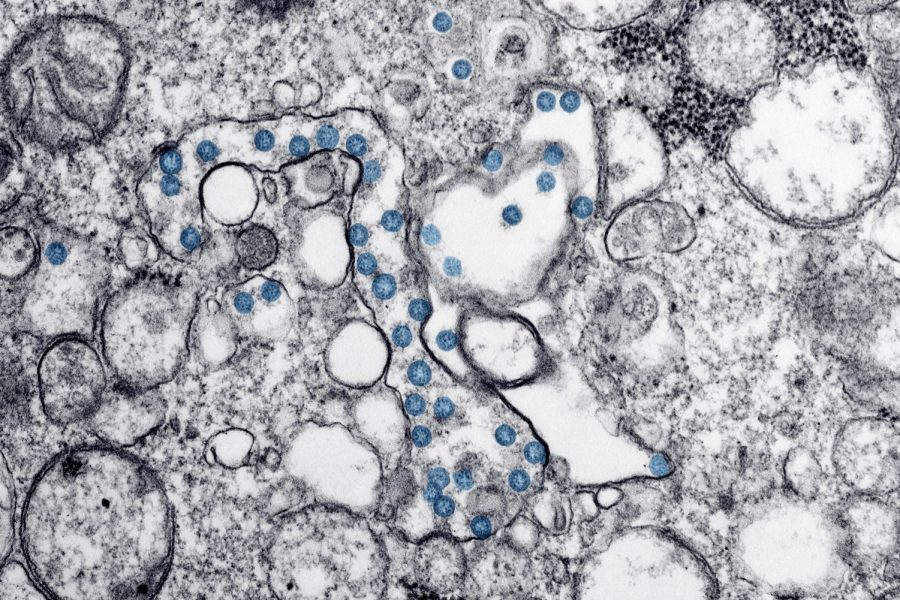 pictured is a transmission electron microscopic image of an isolate from the first U.S. case of COVID-19, formerly known as 2019-nCoV. The spherical viral particles, colorized blue, contain cross-section through the viral genome, seen as black dots. (Centers for Disease Control and Prevention)